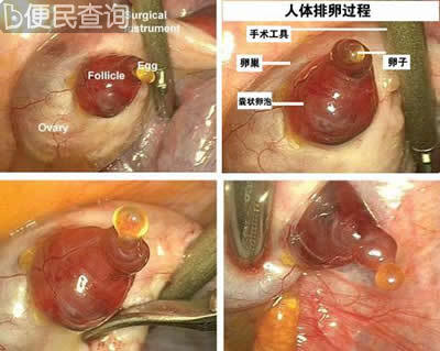 首次拍得人类排卵的过程